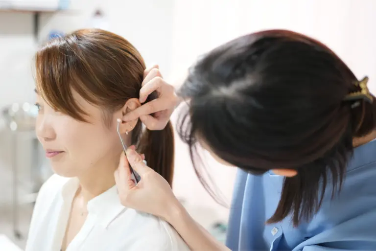 耳ツボジュエリー施術